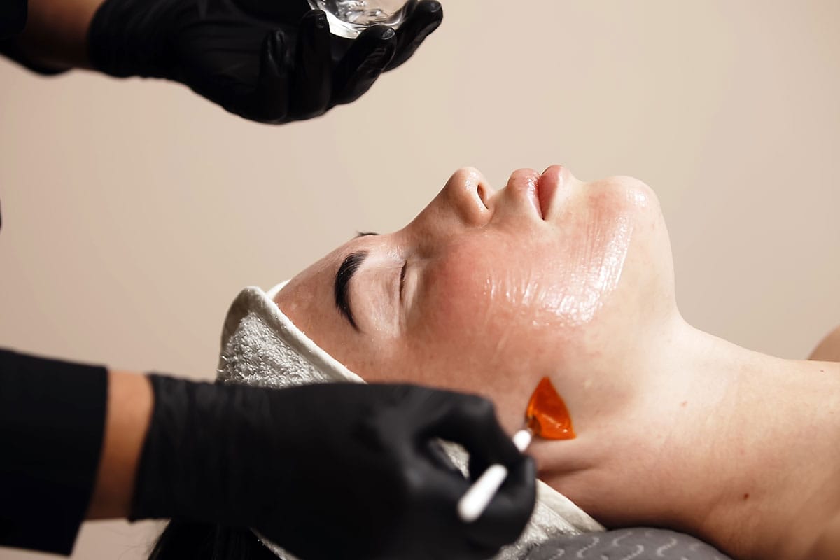 Female laying down with provider performing VI peel treatment on face